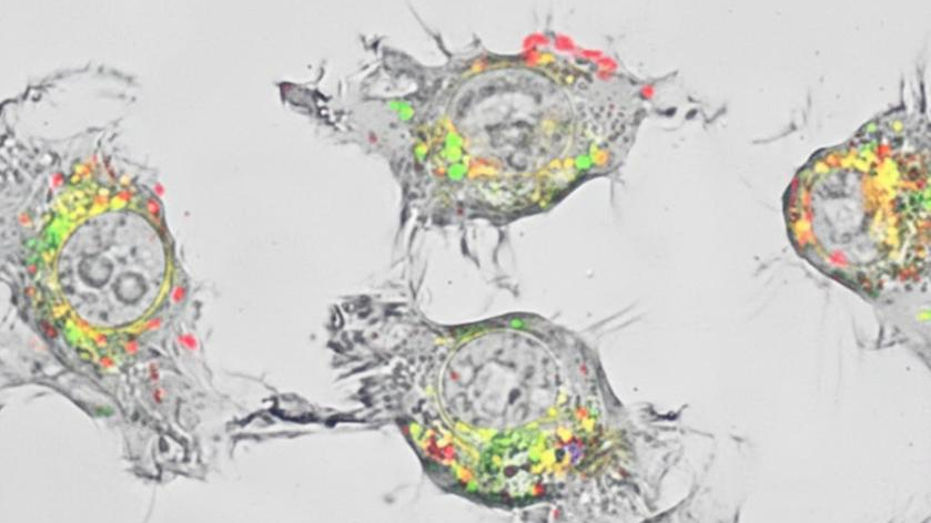 Descoberto tratamento que pode ser até 20 mil vezes melhor contra o câncer Descoberto tratamento que pode ser até 20 mil vezes melhor contra o câncer